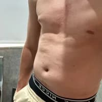 Awkwardguy